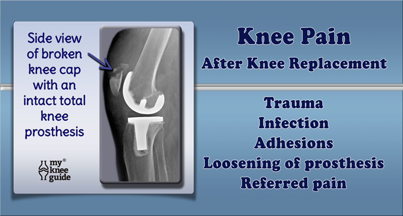 Post-op Knee Pain: Common causes