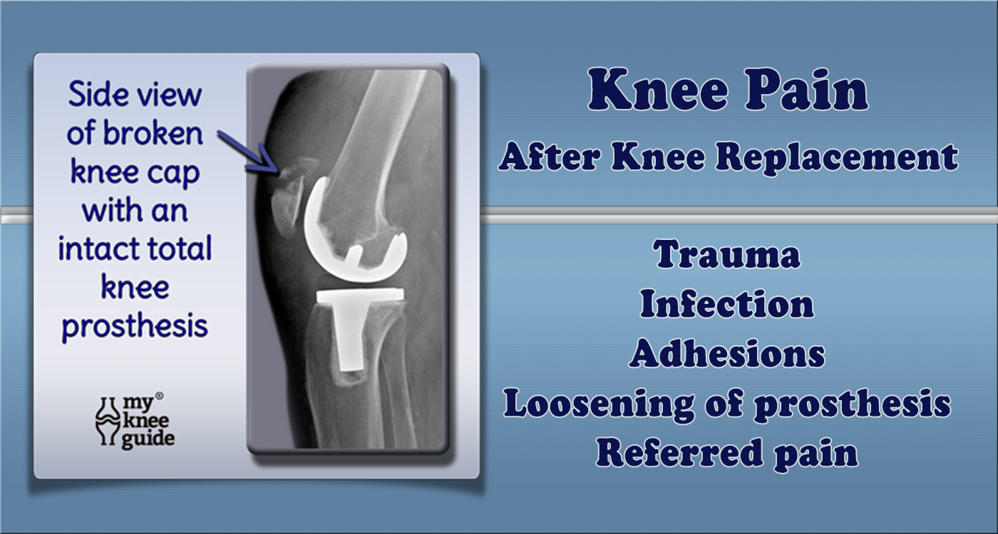 How to manage your pain after knee replacement surgery