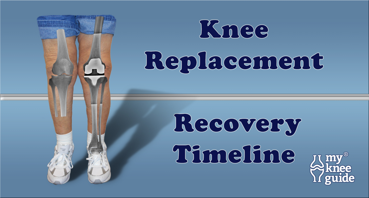 10 Knee replacement surgery recovery ideas  knee replacement surgery, knee  replacement surgery recovery, knee replacement