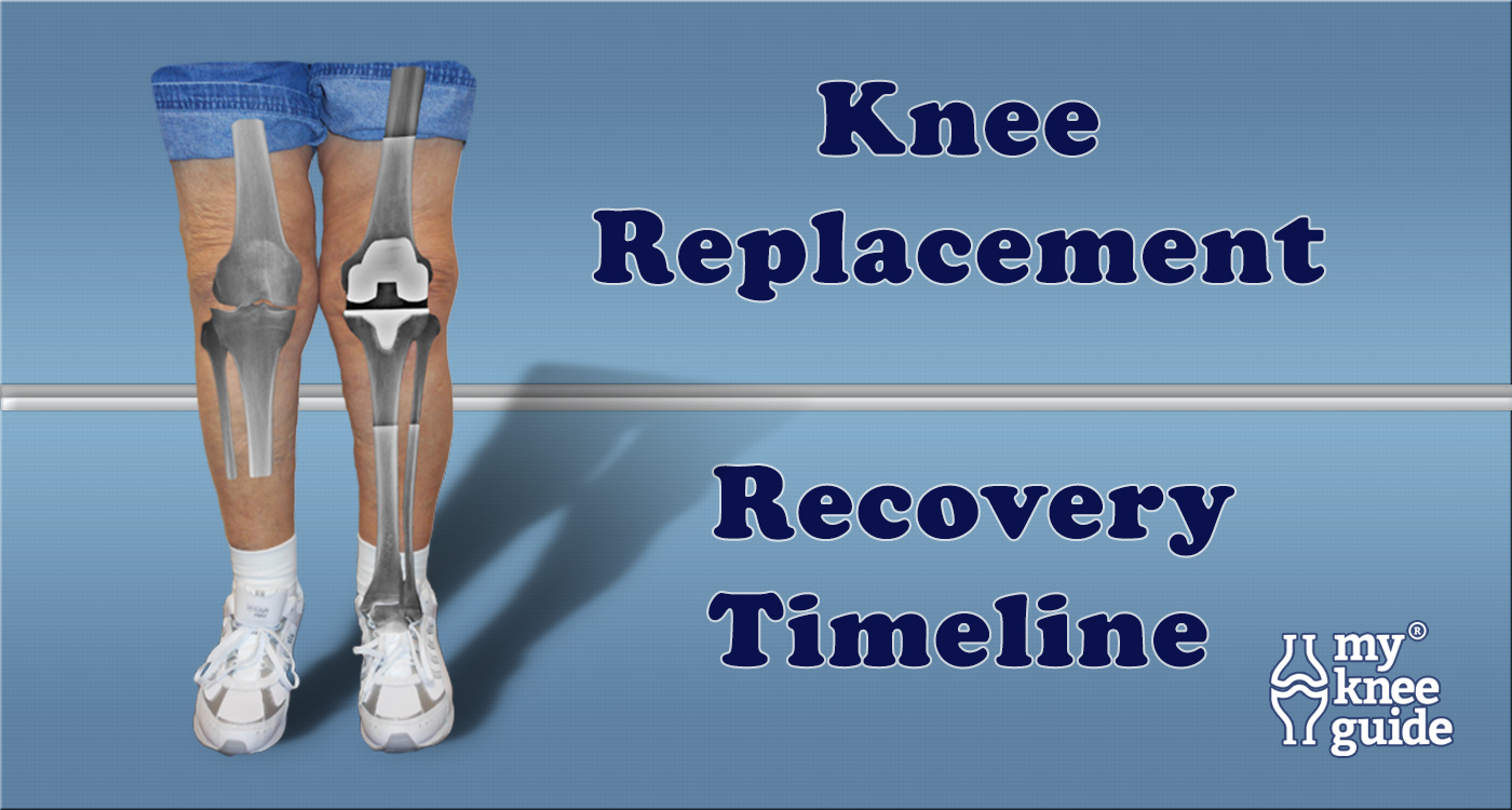 How to Elevate the Leg After Knee Replacement 